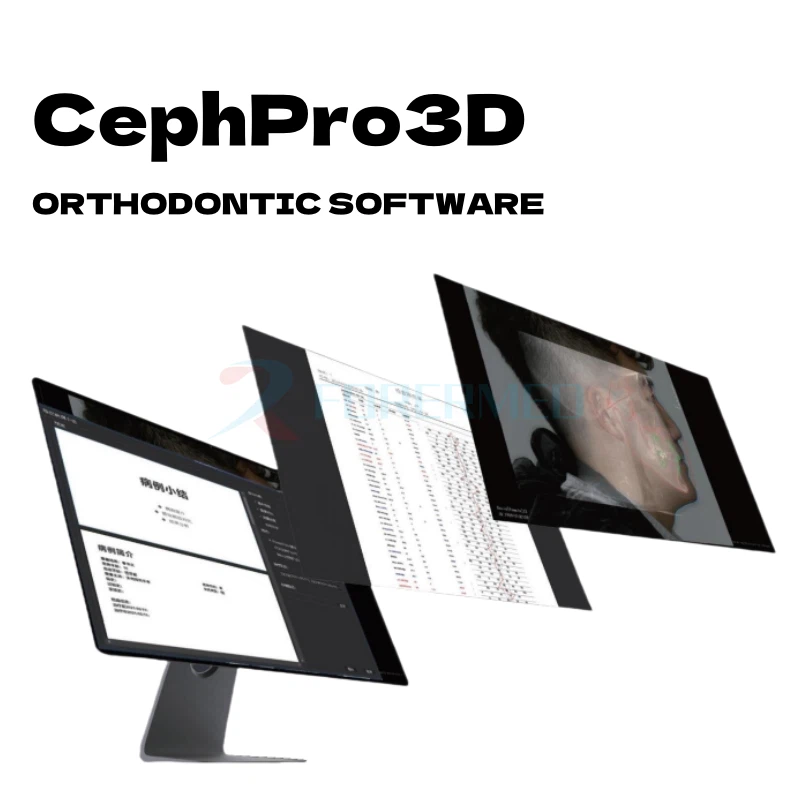 CBCT Scan Dental CBCT Scan Dental