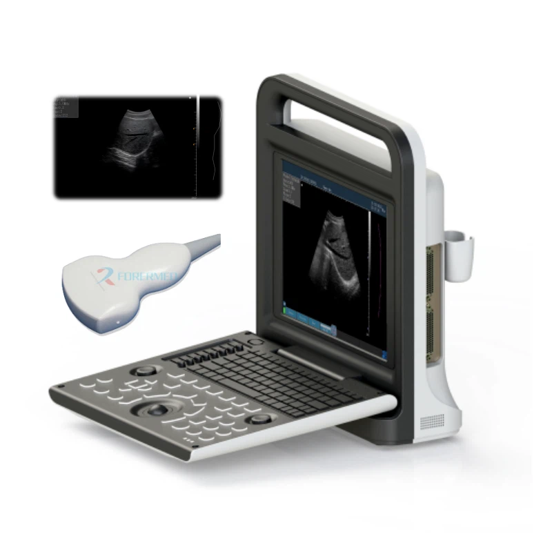 Black And White Ultrasound Machine