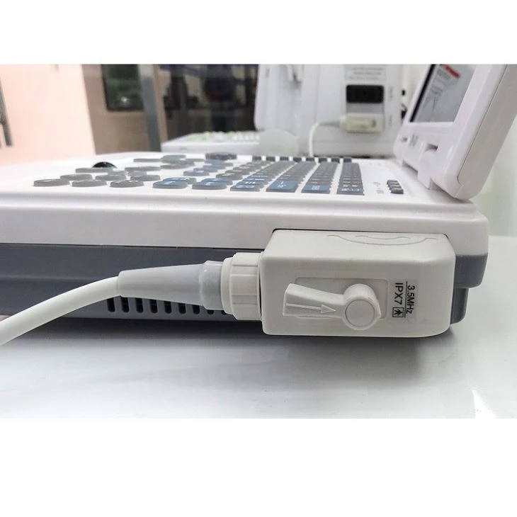 Notebook Ultrasound System Scanner