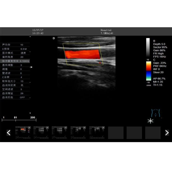 Real-time Doppler 4D Trolley Panoramic Sonoscape Scanner Real-time Doppler 4D Trolley Panoramic Sonoscape Scanner