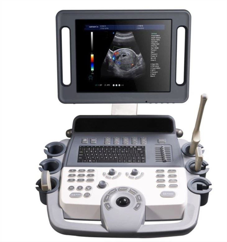 Trolley Color Doppler Full-Digital Laptop Ultrasound Scanner