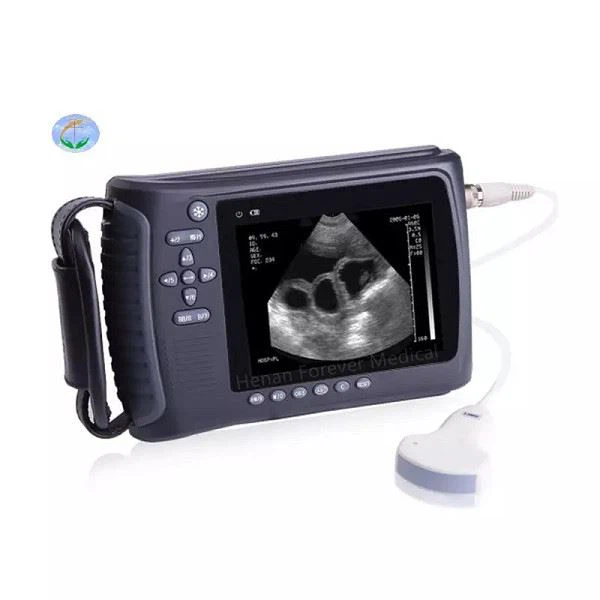 ultrasound ultrasound