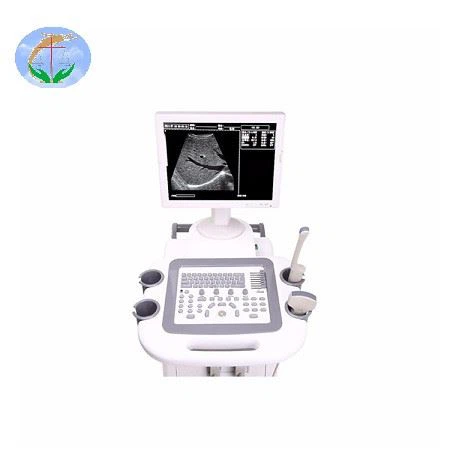 Trolley Ultrasound Scanner YJ-U380T Trolley Ultrasound Scanner YJ-U380T